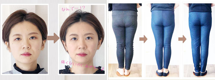 神経整体式 小顔矯正と美容整体の施術前後の写真