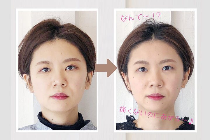 頭・首・姿勢から整える神経整体式リフトアップ小顔矯正の施術イメージ