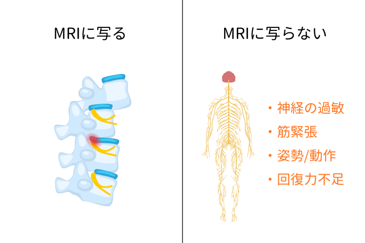 MRI画像診断に写るものと写らないもの