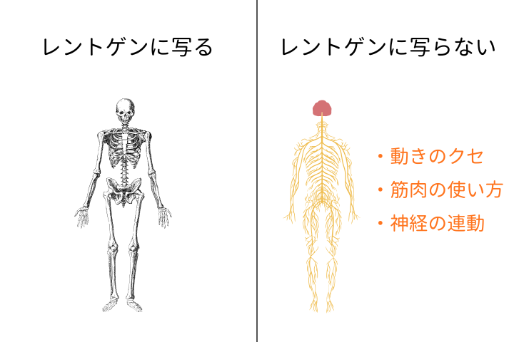 レントゲンで写るもの、写らないもの（動きのクセ・筋肉の使い方・神経の連動）